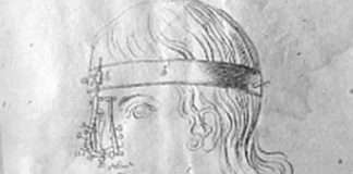 Цікаві факти про пластичної хірургії (5 фото)