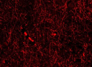 Приховані Мозкові Структури Можуть Революціонізувати Розуміння Нейродегенеративних Захворювань