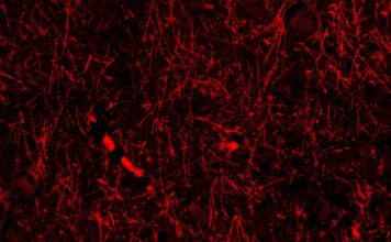 Приховані Мозкові Структури Можуть Революціонізувати Розуміння Нейродегенеративних Захворювань