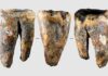 Neanderthals Performed Advanced Dentistry 59,000 Years Ago, Rewriting Human History
