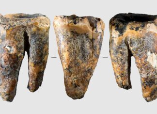 Neanderthals Performed Advanced Dentistry 59,000 Years Ago, Rewriting Human History